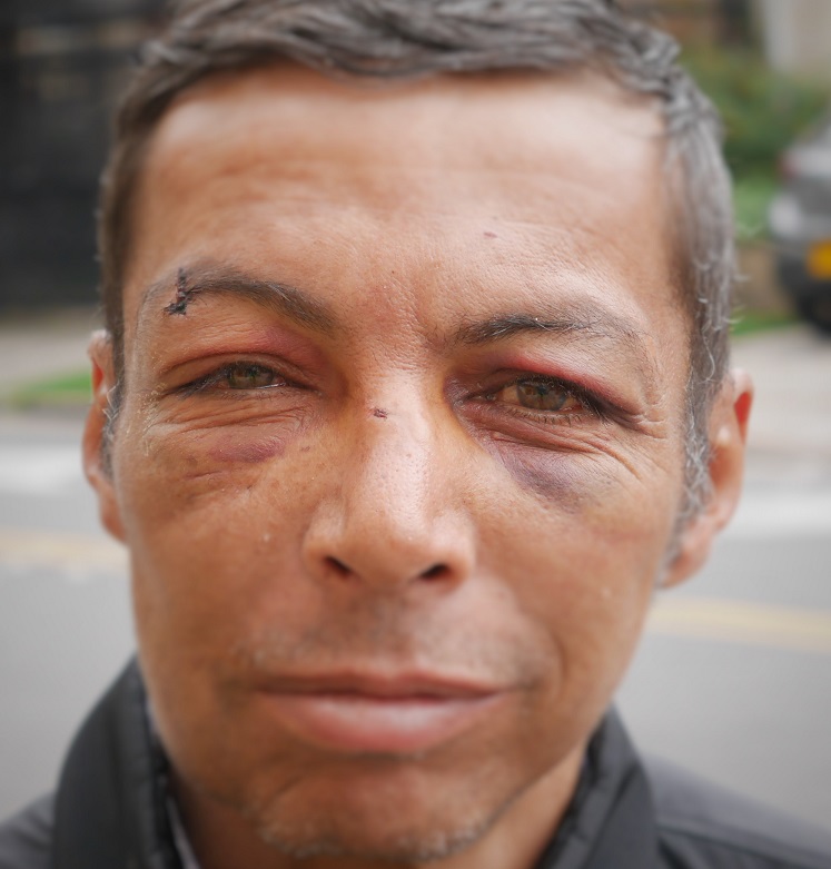 Mauricio 'El Gato' knows the violence on the streets of Bogotá.